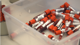Niewielki odsetek Polaków robi testy na HIV. Wirus może pozostawać w uśpieniu nawet 10 lat Wszystkie newsy
