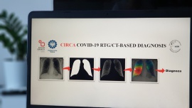 Stworzone w Polsce technologie rozpoznają koronawirusa na zdjęciu rentgenowskim czy tomografii komputerowej [DEPESZA] Depesze