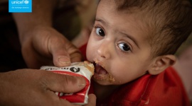 690 mln ludzi na świecie cierpi głód. Świat przegrywa walkę z niedożywieniem! Biuro prasowe